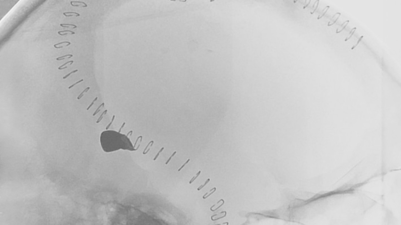 Watch: Bullet in my head song